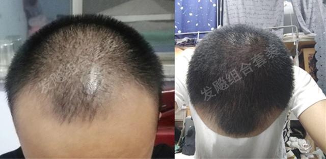 工程廠(chǎng)房燈具 第40頁(yè)